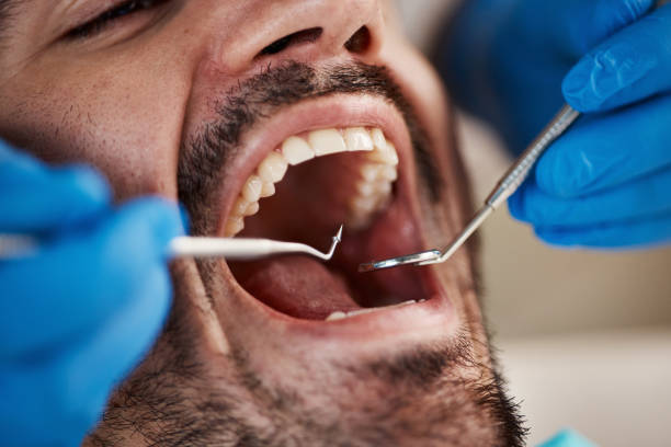 Best Broken or Cracked Tooth Emergency Dentist in Bellevue, MI